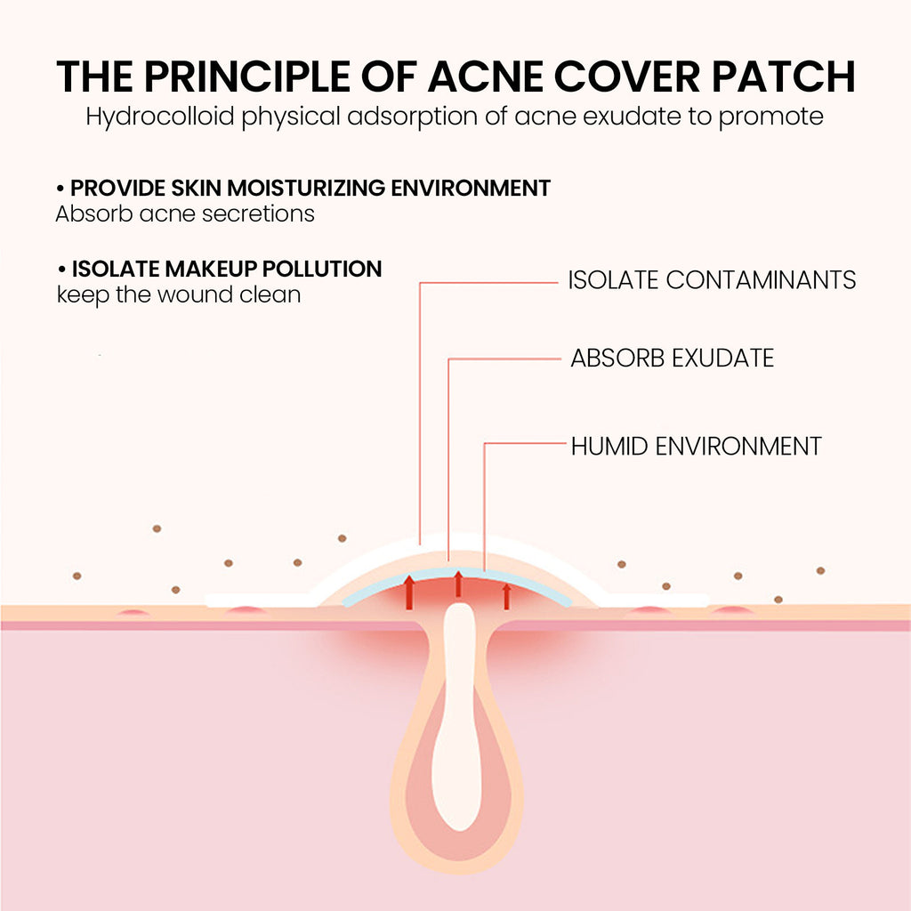 Hydrocolloid Pimple Patches