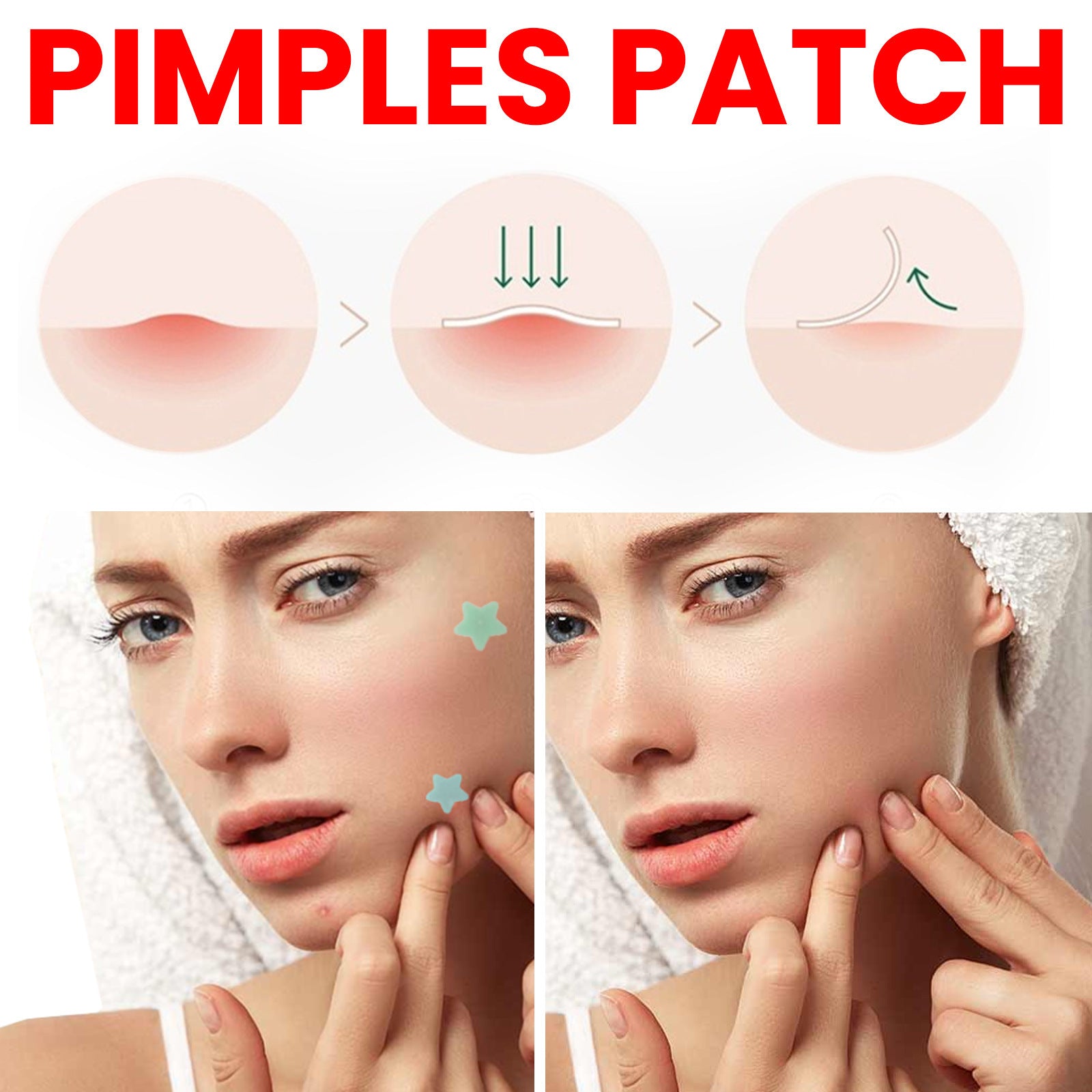 Hydrocolloid Pimple Patches