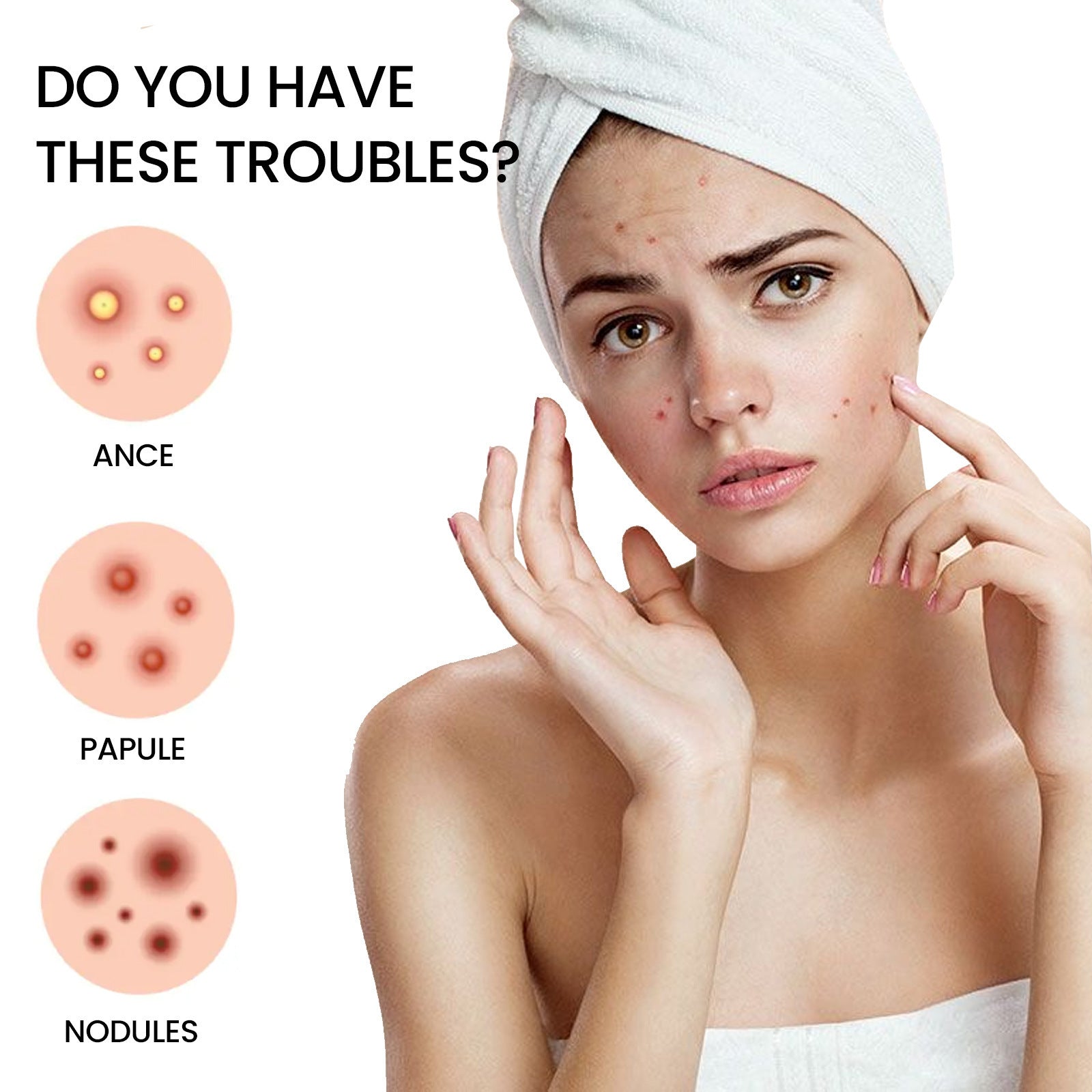 Hydrocolloid Pimple Patches